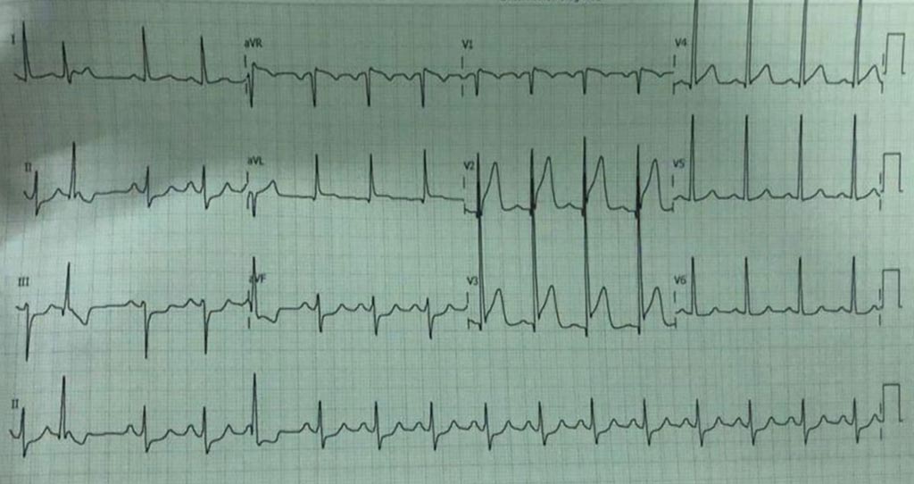Eletrocardiograma